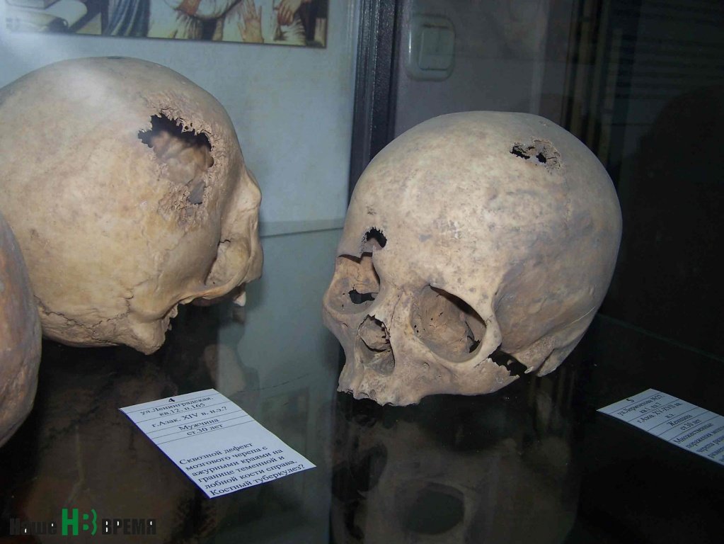 С такими повреждениями черепа древние жители Азова продолжали жить и, возможно, трудиться.