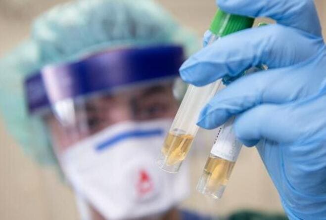 За сутки на Дону выявили 393 инфицированных коронавирусом жителей