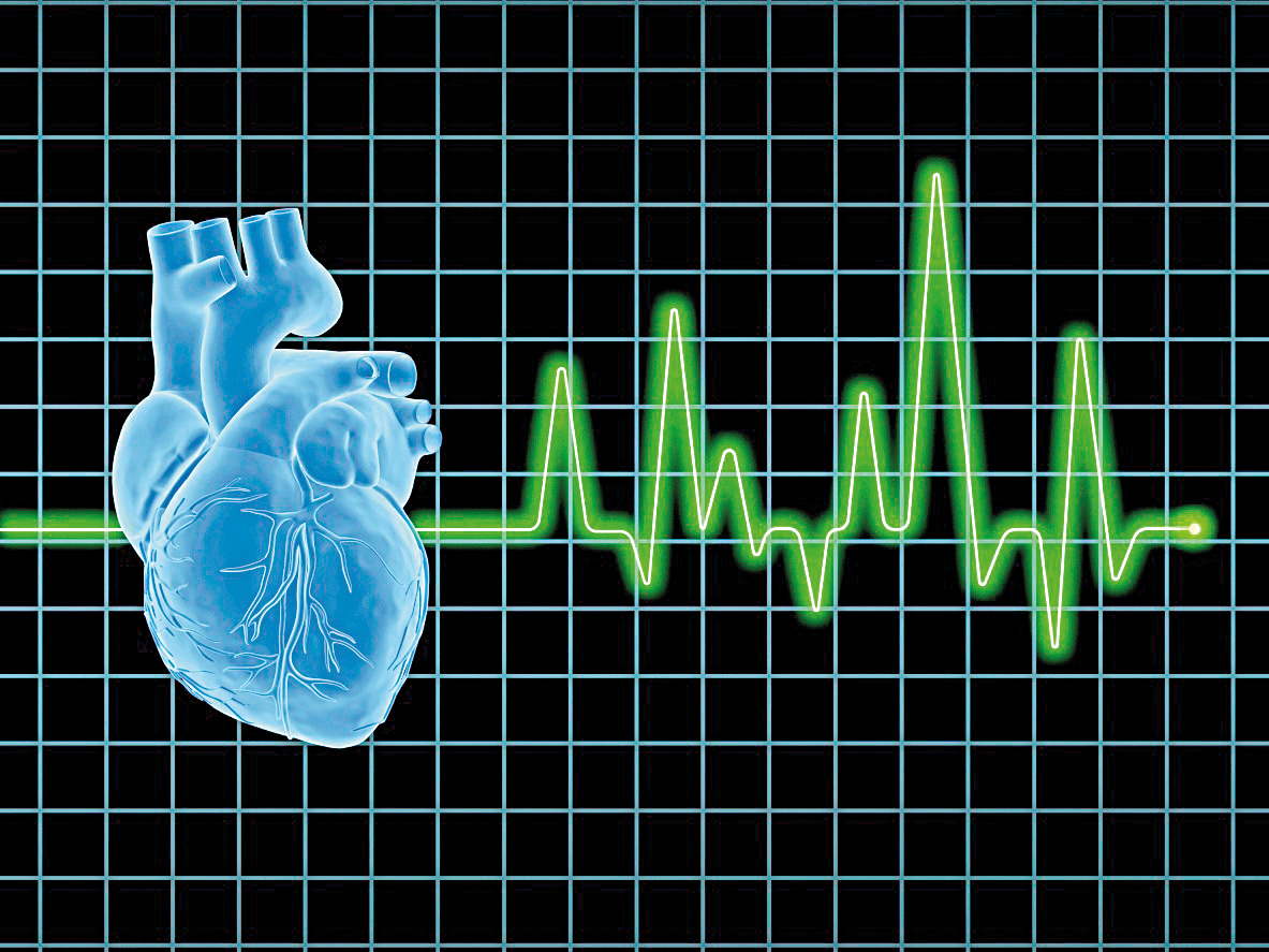 Что такое внезапная остановка сердца?
