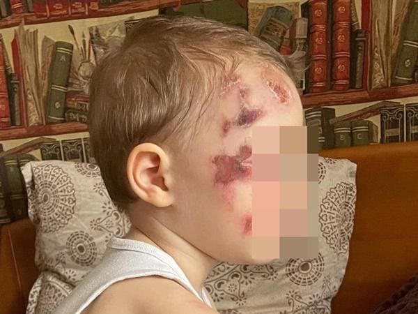 В Ростове-на-Дону электросамокатчик сбил двухлетнего ребенка