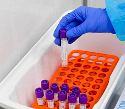 На Дону — осторожный спад: +470 новых случаев COVID-19 за сутки