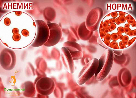 Анемию можно остановить